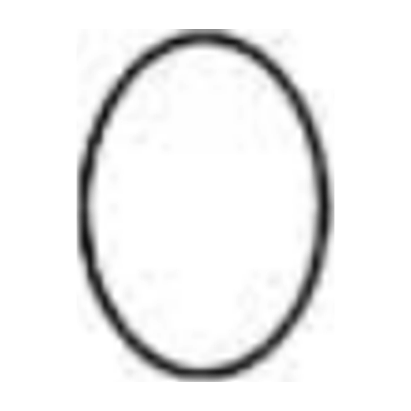 Schroeder Uterine Scoop, Sharp, Rigid, Fig. 2, 31 cm